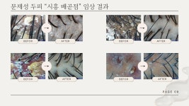 웰킨두피탈모센터 시흥배곧점