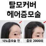 시선을즐기다 토탈 탈모 두피커버 전문샵