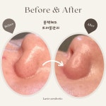 라비에 에스테틱