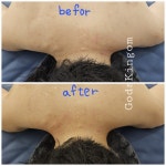 어께관리 등관리 목관리 체형관리 갓스킹덤힐링샵