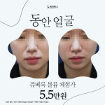 케이톡스의원 부평