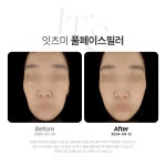 잇츠미의원 동탄