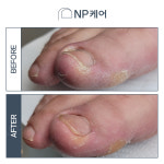 엔피케어 대전서구점