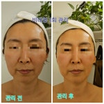 미진뷰티