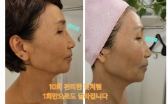 미진뷰티