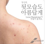 올가스킨 지행동