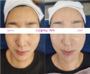 큐엘메디스킨 부천점