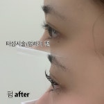 아이라브영