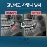 세이브치과의원