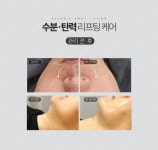 수네에스테틱