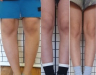 에이치랩대체의학 체형교정센터
