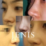 제니스의원