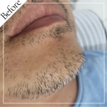 블랑뷰티랩