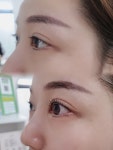 부천피부관리 퓰렌뷰티라운지