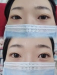 부천피부관리 퓰렌뷰티라운지