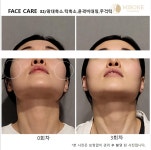 미본 얼굴윤곽관리 신촌점