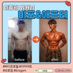 브로짐
