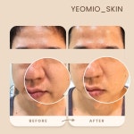 예오미오 스킨케어 의정부금오본점