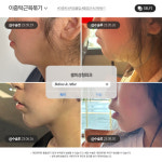 셀피성형외과의원 부산서면역