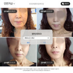 셀피성형외과의원 부산서면역
