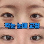 뷰티쏠대곡점 플라즈마블라스트