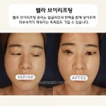 최성희SB발란스앤라인