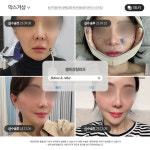 셀피성형외과의원 부산서면역