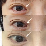 뷰티쏠대곡점 플라즈마블라스트
