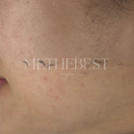 미더베스트 홍대점