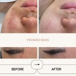 예오미오 스킨케어 의정부금오본점