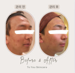 투유스킨케어