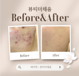 뷰티더채움