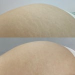 블리스 스킨바디