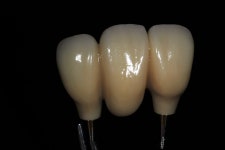 하모니치과기공소