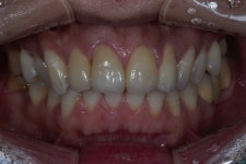 하모니치과기공소