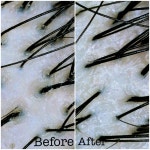 올가드림뷰티 이지더원5차점