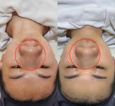 올가드림뷰티 이지더원5차점