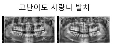 닥터스마일치과의원 수원