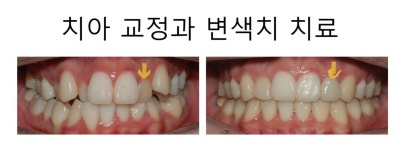 닥터스마일치과의원 수원
