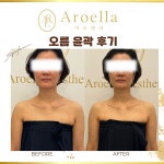 아로엘라 대구본점