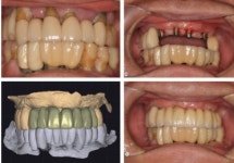 좋은날치과기공소