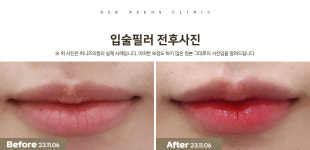 허니즈의원