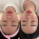 라네쥬에스테틱 & 왁싱