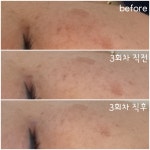 비비뽀얀 포항북구점