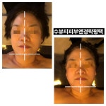 수뷰티피부앤경락 평택마사지