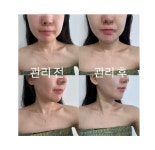 더맑은에스테틱
