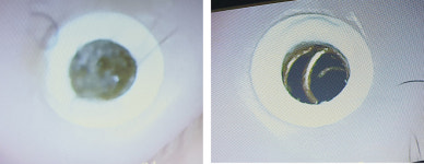 굿모닝보청기 대구지점