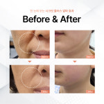 고운스킨케어