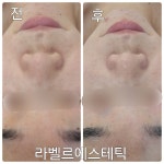 라벨르에스테틱
