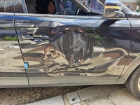 덴트카119